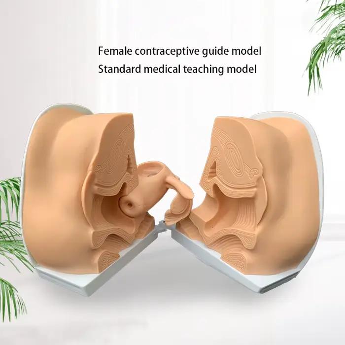 Modèle d'instructions d'installation de dispositif contraceptif féminin, organe reproducteur ovarien
